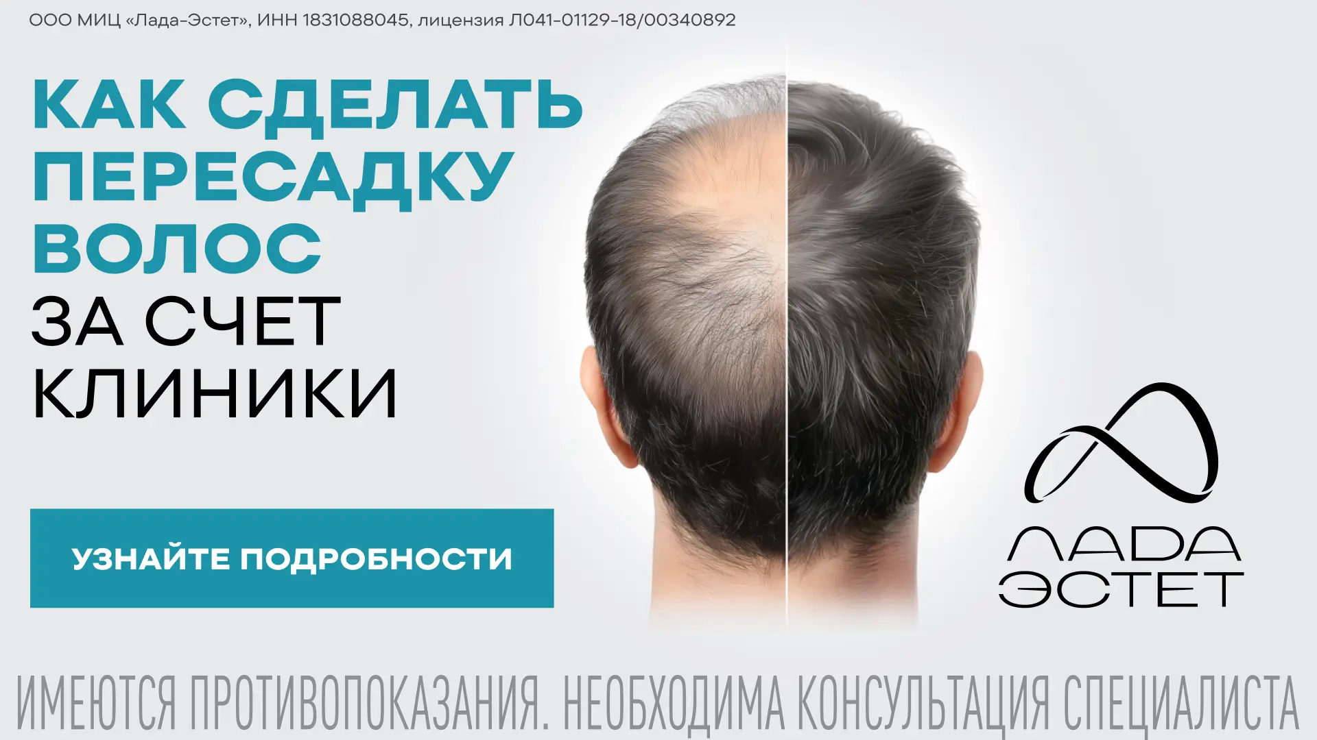 МИЦ «Лада Эстет» объявляет конкурс на пересадку волос