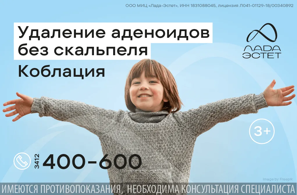 Удаление аденоидов холодной плазмой. Коблация